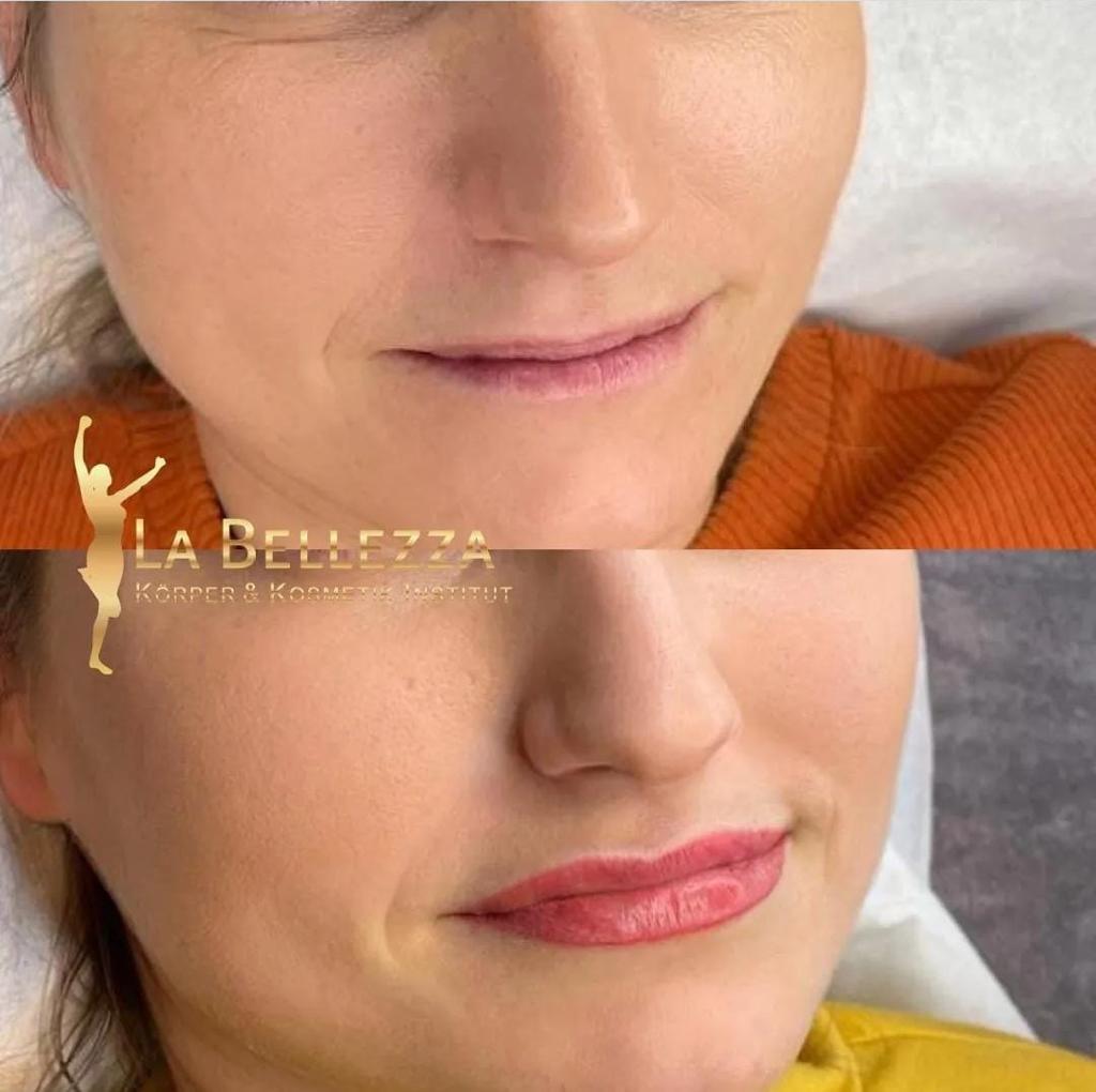 Dokumentierte Lippen-Arbeit bei La Bellezza